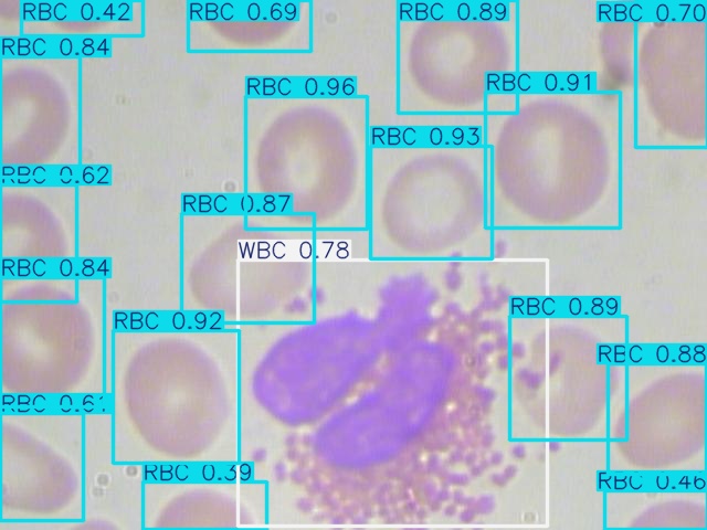 Medical imaging object detection output