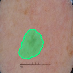 Medical Imaging segmentation output