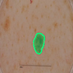 Medical Imaging semantic segmentation result