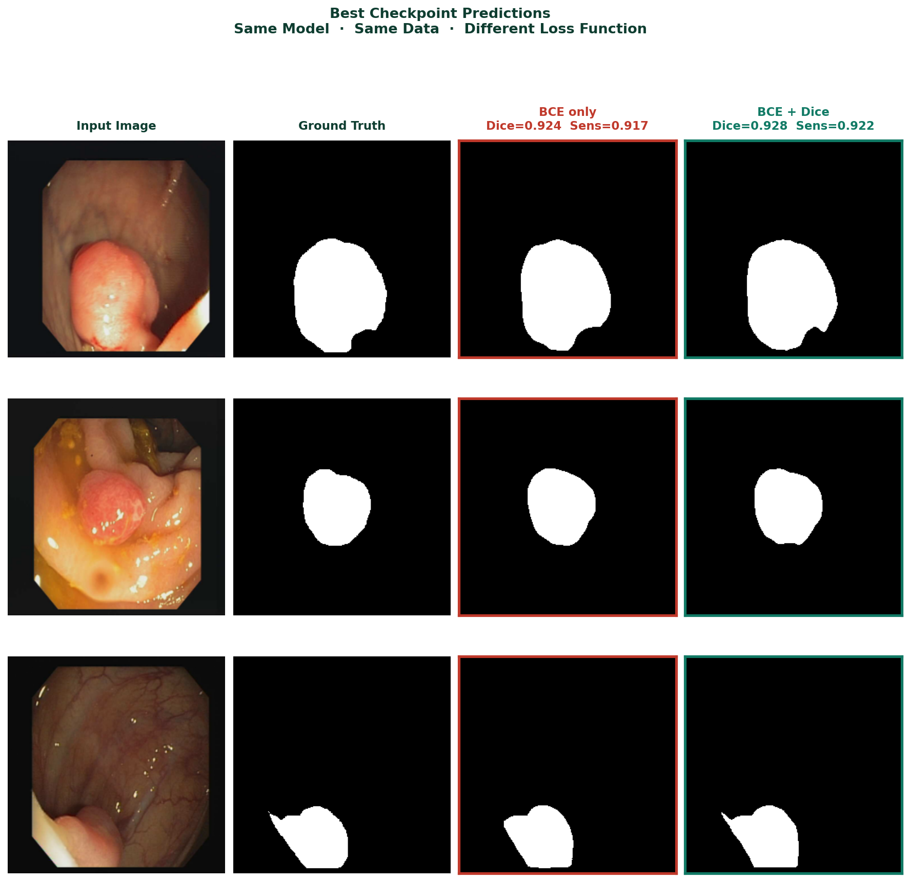 Figure 3 — Side-by-side prediction comparison at epoch 20