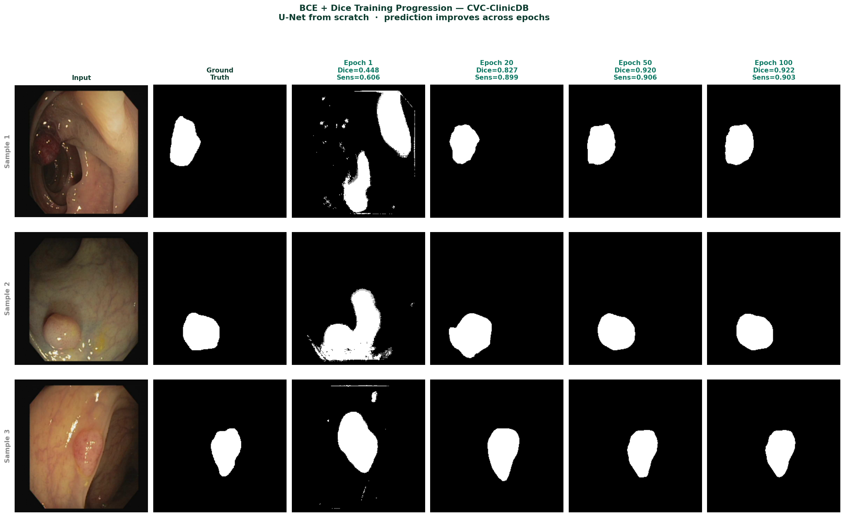 U-Net prediction progression at epochs 1, 20, 50 and 100
