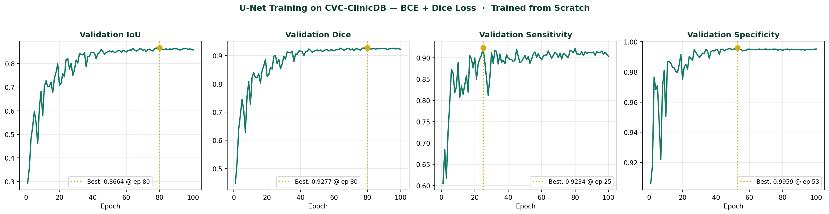 U-Net training curves showing IoU, Dice, Sensitivity and Specificity over 100 epochs