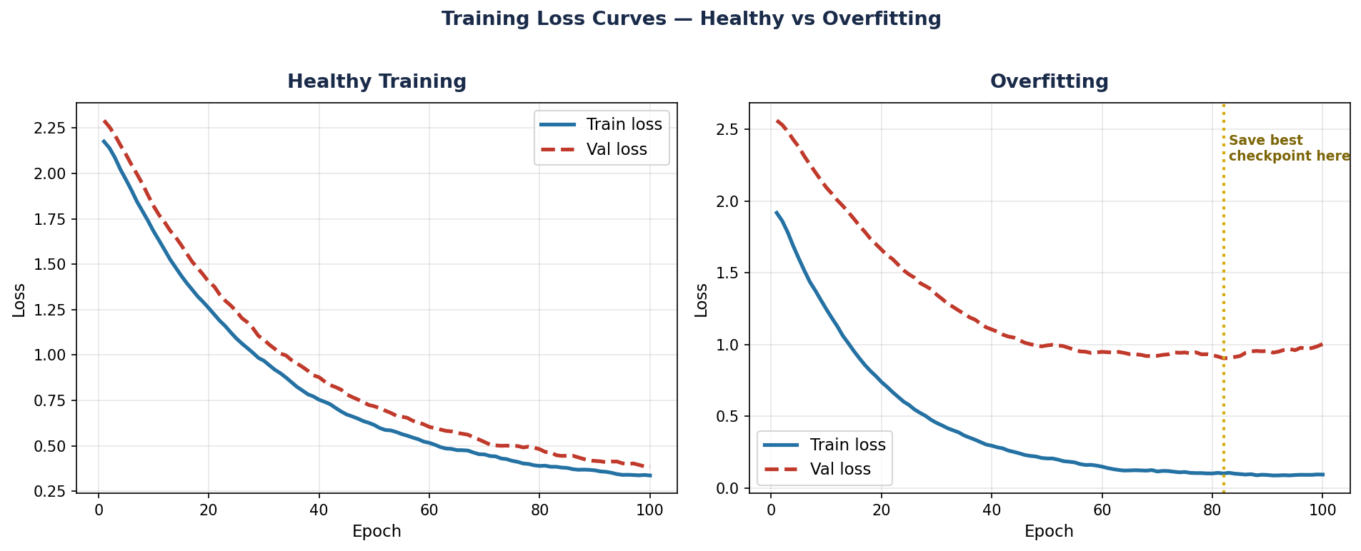 Healthy vs overfitting loss curves